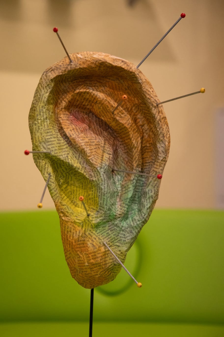 Beispiel:  Akupunktur Nadeln zur Behandlung am Ohr