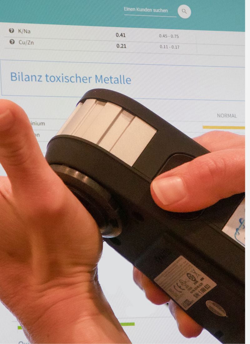 Messung mit dem Vitamedscan in der Handfläche innen